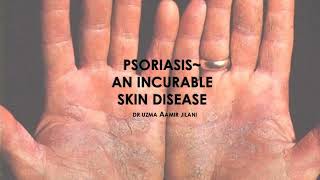 PSORIASIS A SHORT OVERVIEW  DERMATOLOGY  CLINICAL MEDICINE  MEDICAL REVISION GUIDE [upl. by Quennie917]