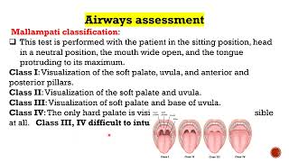 Endotracheal Intubation [upl. by Narib]