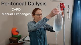 Peritoneal Dialysis PD Manual Exchanges StepbyStep Guide in 2023 [upl. by Jyoti]