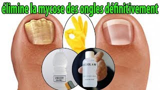 élimine la mycose des ongles définitivement  conseils [upl. by Digirb]