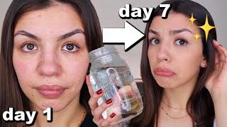 I Drank A Gallon Of Water A Day For One Week  Before And After Results [upl. by Phelia]