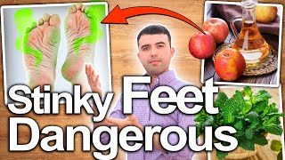 How To Get Rid Of Stinky Feet  5 Home Remedies To Eliminate Feet Stench [upl. by Assirrem]