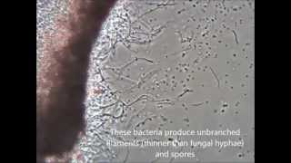 Streptomyces sp [upl. by Akisey]