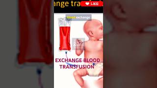 EXCHANGE BLOOD TRANSFUSION  rrb nursingimportantquestions norcet8 exchangebloodtransfusion [upl. by Earlene776]