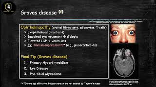 Common Thyroid Diseases Causes [upl. by Suirtimed]