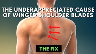 The Underrappreciated Cause of Winged Shoulder Blades  The Fix [upl. by Anaejer]