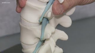 New procedure gives instant relief for spinal stenosis [upl. by Cacilie864]