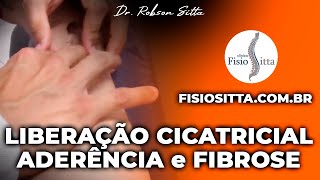 MASSAGEM de LIBERAÇÃO CICATRICIAL PREVENÇÃO ADERÊNCIA FIBROSE Clínica Fisioterapia Dr Robson Sitta [upl. by Aivlis]