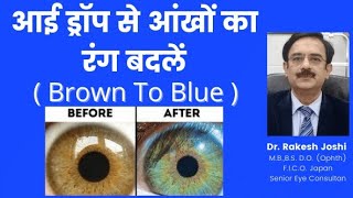 Eye color change by eye drops from brown to blue [upl. by Neenad]