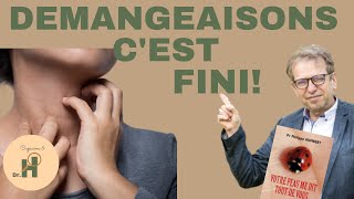 Comment en finir avec les démangeaisons Conseils dun dermatologue [upl. by Aivekal]