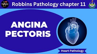 Angina PectorisRobbins Pathology 11Pathology lecturesHeart pathology pathology robbins heart [upl. by Htebaile]