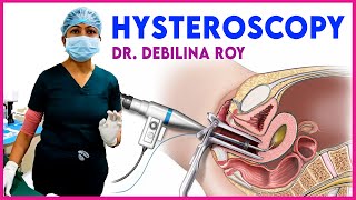 Explaining about hysteroscopy  Our specialist DrDebilina Roy  Iswarya fertility centre Kolkata [upl. by Andre688]