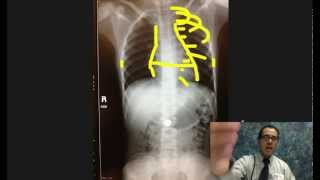 Clinical Cases Chest Xray discussion [upl. by Soutor323]