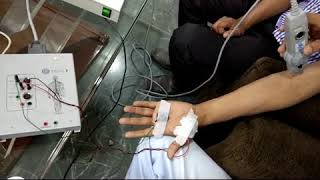 EMG test demonstration  Electromyography EMG [upl. by Parrott866]