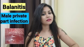 Balanitis male private part infection treatment  Balanitis symptomscauses amp homeopathic medicine [upl. by Harwin359]