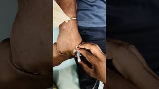 I V Cannula Insertion technique  I V Cannula FixationI  I V injection 💉 shorts reels feed [upl. by Nauqed]