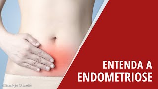 Entenda a Endometriose [upl. by Adiuqal]