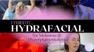 I Triedthe Hydrafacial for Melasma Hyperpigmentation  REBELLE NUTRITION [upl. by Anitnoc]