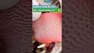 apakah yang berduri duri menyeramkan ini‼️😱 trending shortvideo [upl. by Nyahs]