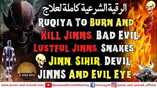 Ruqyah To Burn And Kill Jinn Bad Evil Lustful Jinns Shaytan Sihir Black Magic And Evil Eye [upl. by Neils]