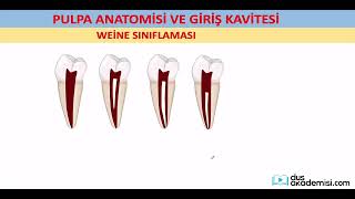 dusakademisicom ENDODONTİ Paketi PULPA ANATOMİSİ KAVİTE ve DENTAL ANOMALİLER Konu Anlatımı [upl. by Monroy]