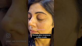 Korean glass treatment 20days resultsshortsytshortsytyoutubeshortsyoutubepinkyhairbeautysalon [upl. by Schulman]