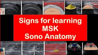 MSK SonoAnatomy [upl. by Anujra]