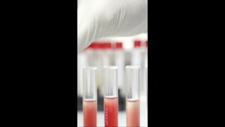 Do a nutritional gene test [upl. by Roderick410]