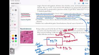 JodBasedow Phenomenon endocrinology 46  First Aid USMLE Step 1 in UrduHindi [upl. by Fabrin]