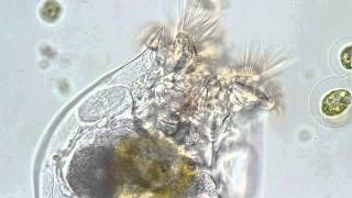 Brachionus rotifer [upl. by Kersten175]