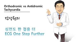 심전도 한 걸음 더 20 정방향 역방향 방실회귀빈맥 orthodromic antidromic AVRT [upl. by Eustache568]