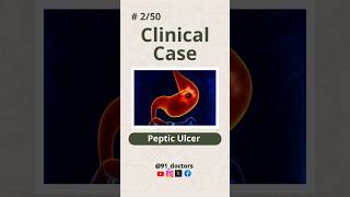 Severe Stomach Pain Know the Real Cause Behind Peptic Ulcers shorts youtubeshorts viralvideo [upl. by Isle602]