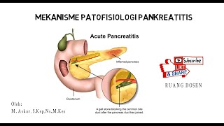 MEKANISME PATOFISIOLOGI PANKREATITIS [upl. by Nylednarb]