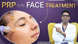 PRP for face  PRP for face treatment  PRP for face benefits  PRP treatment for face cost in India [upl. by Ateuqahs]