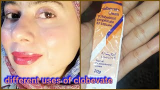 Clobevate cream for whitening  zartasha zar  clobevate cream [upl. by Elegna]