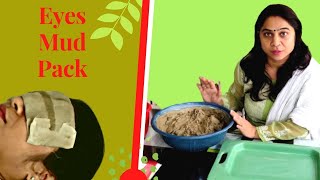 How to make Eye Mud Pack naturopathy [upl. by Ydorb]