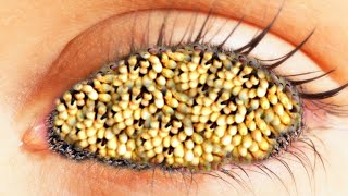 ASMR Eye Treatment Animation Remove Maggots Infection  ASMR eye 2d animation SanjayAsmr1 [upl. by Nottnerb58]