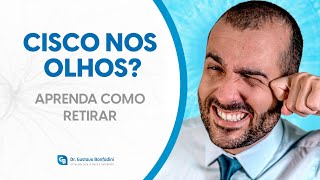 Cisco nos olhos Descubra como retirar sem machucar • Dr Gustavo Bonfadini [upl. by Reel377]