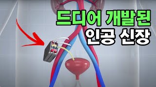 과학자들이 드디어 인공 신장을 만들었습니다 임상이 얼마 남지 않았습니다 [upl. by Nol]