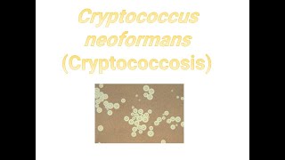 Cryptococcus neoformans I Cryptococcosis I Medical mycosis I Medical microbiology I [upl. by Anahsahs132]