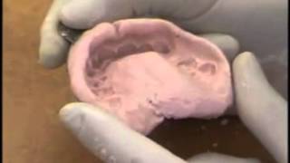 Upper Alginate Impression Evaluation [upl. by Ocram967]