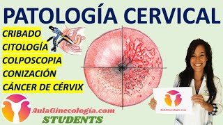 PATOLOGÍA CERVICAL AulaGinecología  STUDENTS CRIBADO COLPOSCOPIA CONIZACIÓN CÉNCER DE CÉRVIX [upl. by Daitzman]