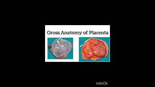 Gross Anatomy of Placenta shorts shortvideo [upl. by Fabe]