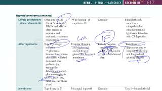 32 Nephritic Syndrome  Diffuse proliferative glomerulonephritis  Alport syndrome  MPGN [upl. by Marchelle]