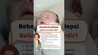 Bebeklerde Epilepsi Belirtileri Nelerdir [upl. by Sadiras]