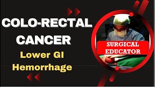 COLORECTAL CARCINOMA How To DIAGNOSE amp TREAT Lower GI Hemorrhage [upl. by Arras]