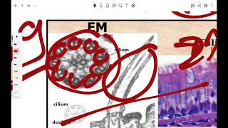 cytoskeletonampinclusion [upl. by Morice]