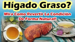 COMO CURAR EL HIGADO GRASO CON REMEDIOS CASEROS Higado Graso Tratamiento Natural [upl. by Vincelette]