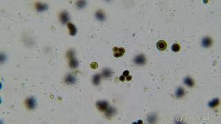 The Haematococcus pluvialis [upl. by Fishman]