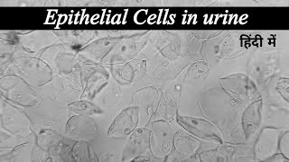 Epithelial cells in urine in hindi [upl. by Refiffej]